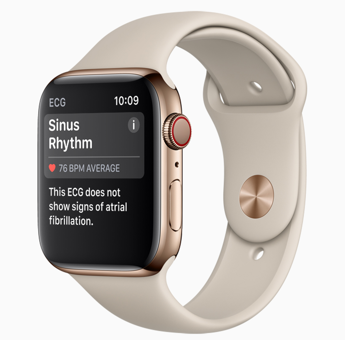 Are Apple Watch innovations good for consumers?